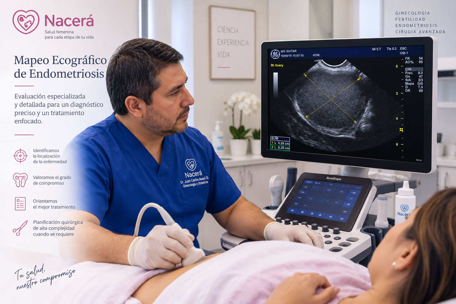 Mapeo ecográfico de endometriosis realizado en Nacerá